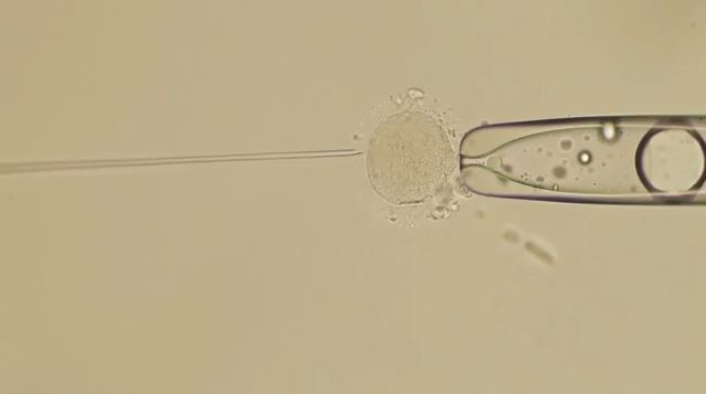 Ανησυχία για τον δότη σπέρματος με την καρκινογόνο μετάλλαξη – Ειδικοί αναλύουν