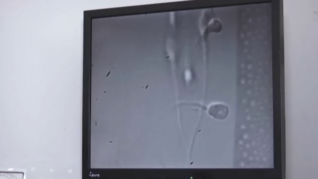 Δότης σπέρματος με καρκινογόνο μετάλλαξη απέκτησε 200 παιδιά – 18 παιδιά γεννήθηκαν στην Ελλάδα, το ένα νοσεί