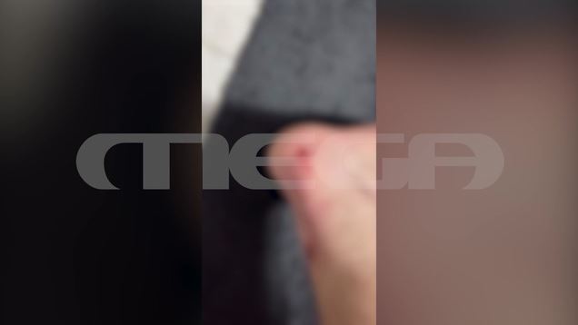 Αίγιο: Απολογείται αύριο ο 46χρονος που πυροβόλησε κατά 4 ανηλίκων