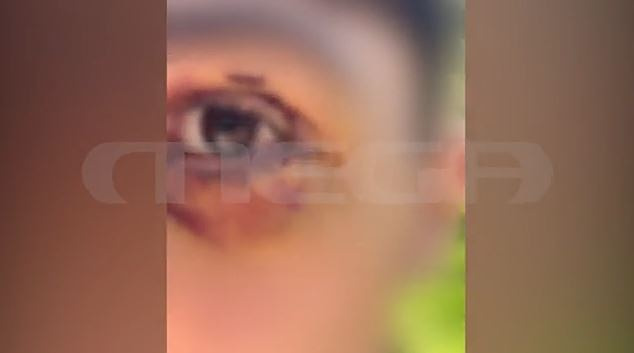 Ιωάννινα: Ενέδρα ανηλίκων σε 16χρονο – Τον ξυλοκόπησαν & τον χτυπήσαν με σιδερογροθιά