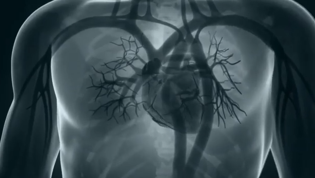 Ποιοι είναι οι πιο συχνοί τύποι μυοκαρδιοπάθειας – Πώς επηρεάζουν την καθημερινότητα των ασθενών