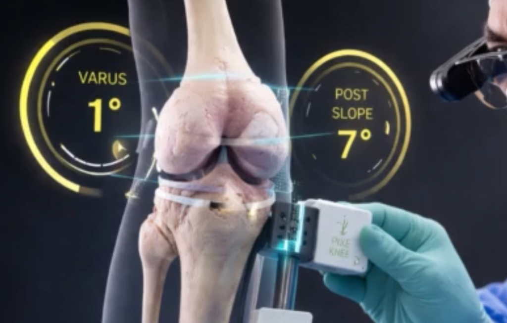 Η επαυξημένη πραγματικότητα (Augmented Reality) στην ορθοπαιδική χειρουργική – Το σύστημα A.R. Pixee