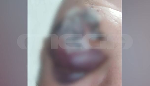 Πάτρα: «Χτύπησα σοβαρά» λέει θύμα ξυλοδαρμού επειδή αρνήθηκε να δώσει χρήματα στον γείτονά του – MEGA αποκλειστικό