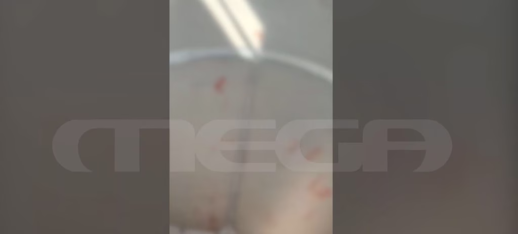 Βούλα: Νεαρός επιτέθηκε με σπασμένο μπουκάλι σε επιβάτη & τον τραυμάτισε