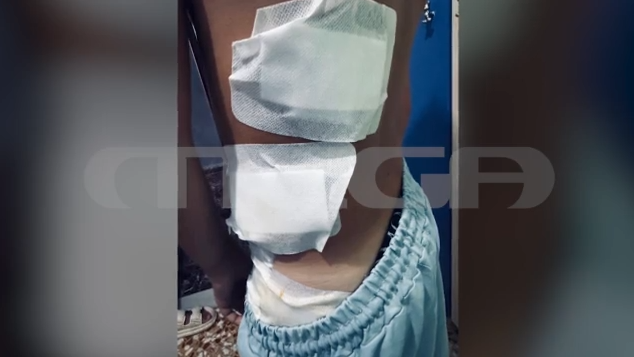 Κρήτη: Στο νοσοκομείο 12χρονος μετά από επίθεση πίτμπουλ – Συνελήφθη 28χρονη