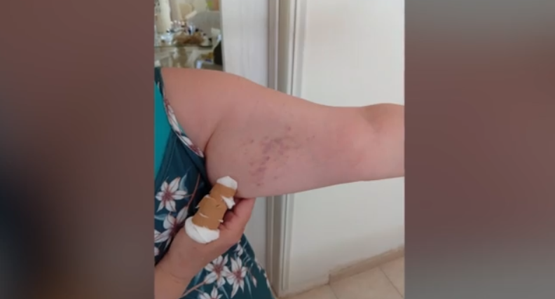 Βόλος: Γιατρός χτύπησε συνοδό ασθενούς στα Επείγοντα του νοσοκομείου