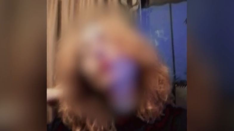 Πάρος: Παραδέχθηκε τη χρήση ουσιών η 21χρονη που νοσηλεύεται στο Τζάνειο